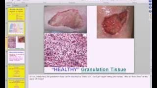 Medical School Pathology 2013 Season Session #5 Regeneration and Healing