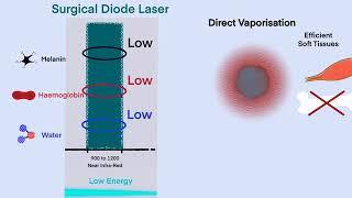 StudyLaser - Near Infra-Red Surgical Diode Laser Mechanism