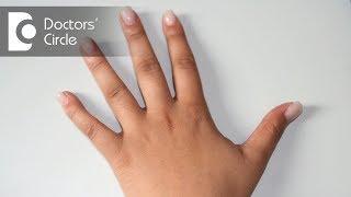 Dark knuckles  Causes & Tips to lighten them - Dr. Rasya Dixit