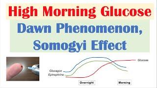 High Early Morning Glucose  Dawn Phenomenon & Somogyi Effect