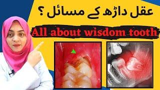 Wisdom Tooth FAQs  Aqal Darh ka nikalna Urdu