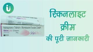 skinlite cream ke fayde labh upyog nuksan lagane ka sahi tarika uses review price in hindi