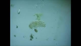 Tardigrade  Water Bear  Moss Piglet