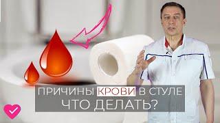 КРОВЬ В КАЛЕ ЧТО ДЕЛАТЬ ПРИ НАЛИЧИИ КРОВИ В СТУЛЕ? ПРИЧИНЫ И МЕТОДЫ ЛЕЧЕНИЯ