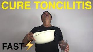 How to cure tonsillitis naturally