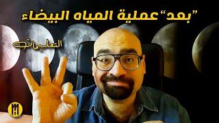 تلاتة .. بعد عملية المياه البيضاء .. التعليمات