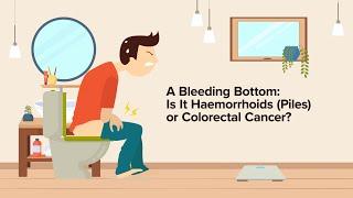 The Bleeding Bottom Is It Piles or Colorectal Cancer?