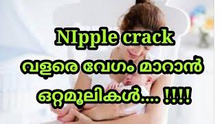 NIPPLE CRACK വളരെ വേഗം മാറാൻ  ഒറ്റമൂലികൾ... 