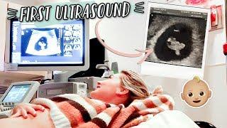 FIRST PREGNANCY ULTRASOUND + HEARING BABYS HEARTBEAT