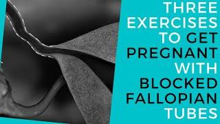 Three Exercises To Get Pregnant With Blocked Fallopian Tubes  Without Surgery