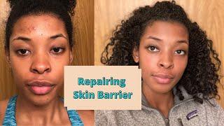 My 2020 Skincare Routine  How to Repair an Irritated Skin BarrierDark Spots