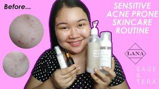 Skincare Routine for Sensitive Acne Prone Skin l Skincare Basics