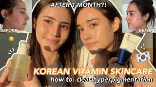 HOLY GRAIL Korean *vitamin* skincare for hyperpigmentation  bright & glowy skin in just 1 MONTH?