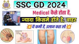 SSC GD 2024 Medical Test Details  SSC GD Medical Me kya kya hota hai ssc gd medical kaise hota hai