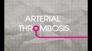 Arterial Thrombosis Explained