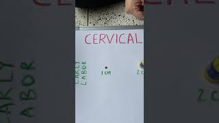 Cervical Dilation during Labor