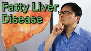 How to Reverse Fatty Liver Disease Naturally  Jason Fung