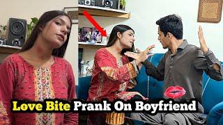 Love Bite Prank On Boyfriend Gone Extremely Wrong  He Slapped Me