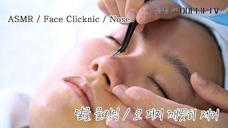 ASMR 코 피지 완벽제거 얼굴을 깨끗히 청소했어요. Black Head Removal