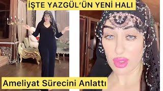 İŞTE YAZGÜL’ÜN YENİ FİZİĞİ Karın Germe Amelliyatı