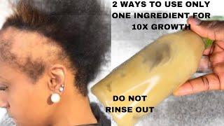 THIS HAIR GROWTH RECIPE SAVED MANY LIVES IN 1 WEEK AFTER  RELEASE ON THE INTERNET SEE WHAT HAPPENS