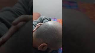 HIJAMA HAIR GROWTH