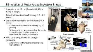 US neuromodulation of motor function and epilepsy with Dr. Seung-Schik Yoo