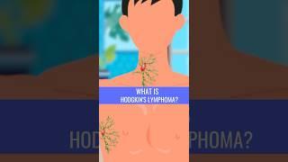 What is HODGKINS LYMPHOMA?