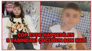 Bursada çöp eve hapsedilen 9 yaşındaki çocuğun son hali