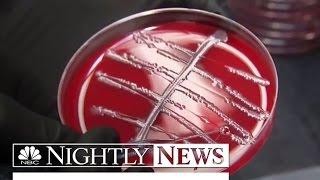 Drug-Resistant Superbugs Are ‘Fundamental Threat’ To Humans WHO Says  NBC Nightly News