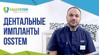 Система дентальных имплантов Osstem  Зубной имплант Остем