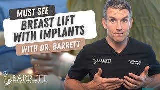 Amazing Breast Lift With Implants  Barrett Plastic Surgery