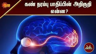 கண் நரம்பு பாதிப்பின் அறிகுறி என்ன?  5Min  Tamil Interview  Tamil News  Sun News