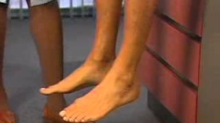 04 Edema Insufficiency & Varicosities