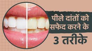 पीले दांतों को सफेद कैसे करें?  How to Whiten Teeth at Home?  Home Remedies for White Teeth