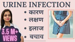 Urine Infection Ke कारण लक्षण Treatment Home Remedy  Peshab me Jalan ka Gharelu Ilaj in Hindi