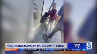 Video shows man slapping child with autism in Pacoima