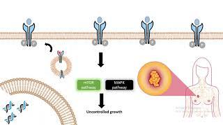 Clinical usage of antibody Herceptin Antibody as breast cancer medicine