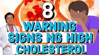 8 Warning Signs ng High Cholesterol - Tips by Doc Willie Ong Internist and Cardiologist