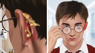 ASMR Help Harry Porter treat ear injuries caused by wearing glasses for too long  WOW Brain Video