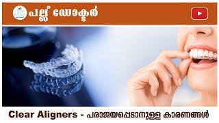 Clear Aligner പരാജയപ്പെടാനുള്ള കാരണങ്ങൾ   The Leading Cause of Clear Aligner Failure