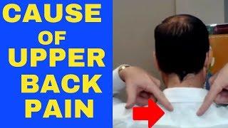 Cause of Upper Back Pain Between Shoulder Blades and Neck -Chiropractor in Vaughan Dr Walter Salubro