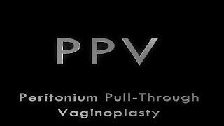 PriyaMED presents... Sugars PPV GRS SRS GCS Vaginoplasty