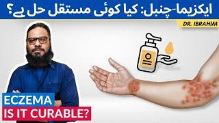 EczemaChambal Ka Ilaj  How To Treat Eczema  Jild Ki Kharish Ka Ilaj UrduHindi Dr. Ibrahim