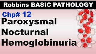 Ch12  Paroxysmal Nocturnal Hemoglobinuria  Blood Pathology  Dr Asif Lectures