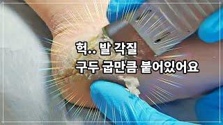 계속 보게 되는 발 각질 제거 중독 영상