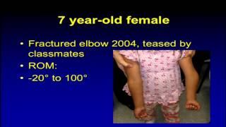 Complications of pediatric elbow fractures