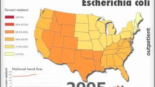 Trimethoprim sulfa-resistant Escherichia coli Outpatient