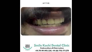 Smile Kochi Dental Clinic  Kadavanthara  PalarivattomSmile Kochi Dental Clinic