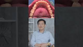Trồng răng implant tại Lạc Việt Intech  Lạc Việt Intech Implant #lvnw #short